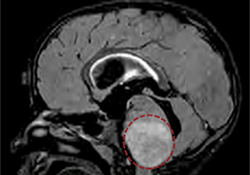 Brainstem