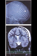 Brain image