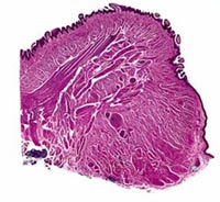 A digital slide showing skeletal muscle