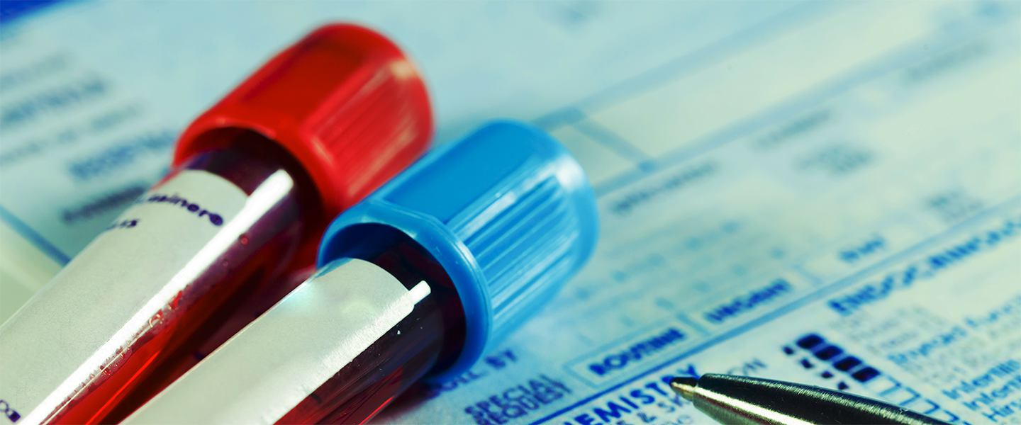 blood_test_vials_1440x600.jpg
