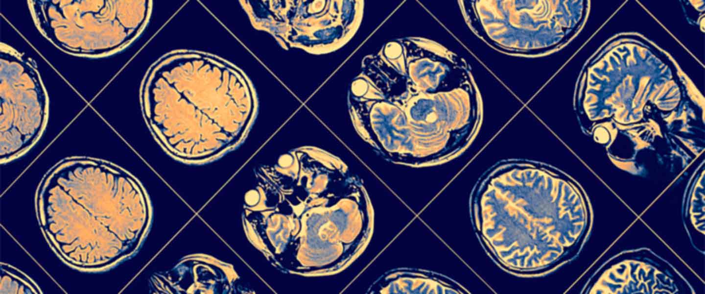brain-scans-top-1440x600.jpg