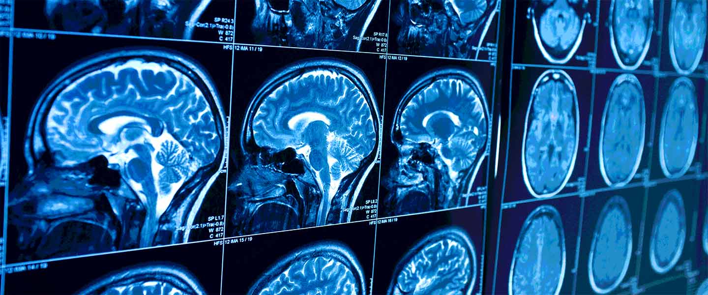 brain_scans_1440x600.jpg