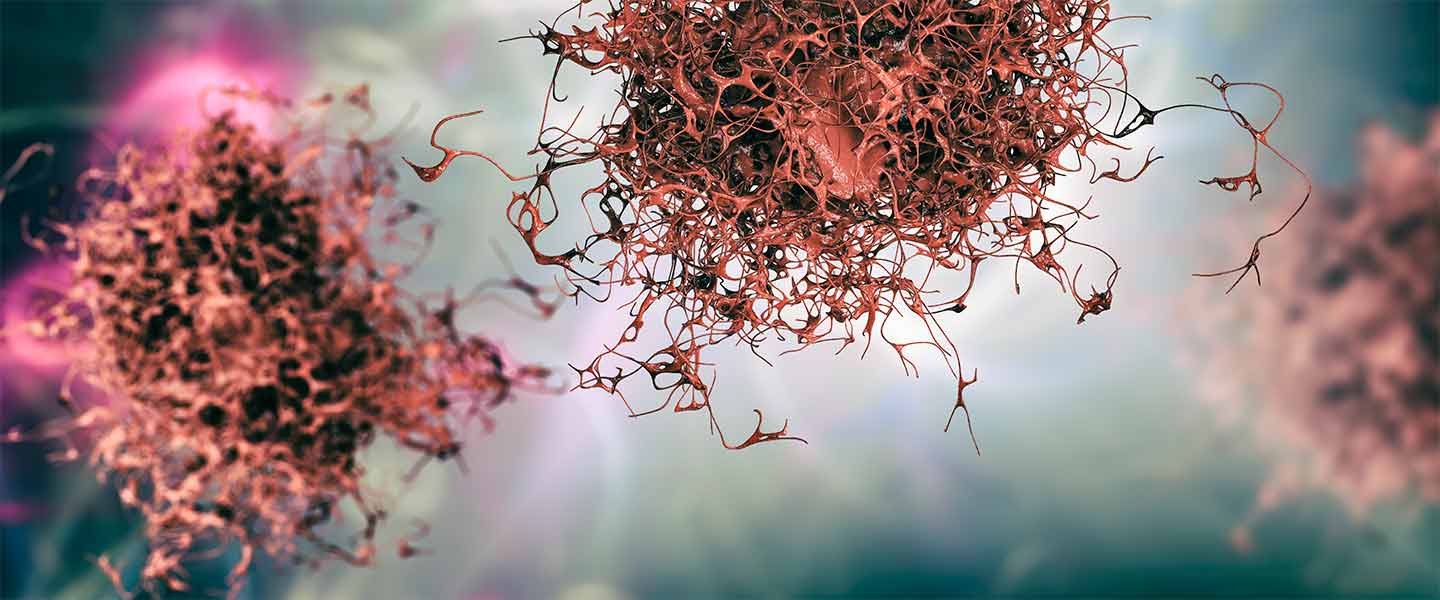 cancer-cell-treatment-1440x600.jpg