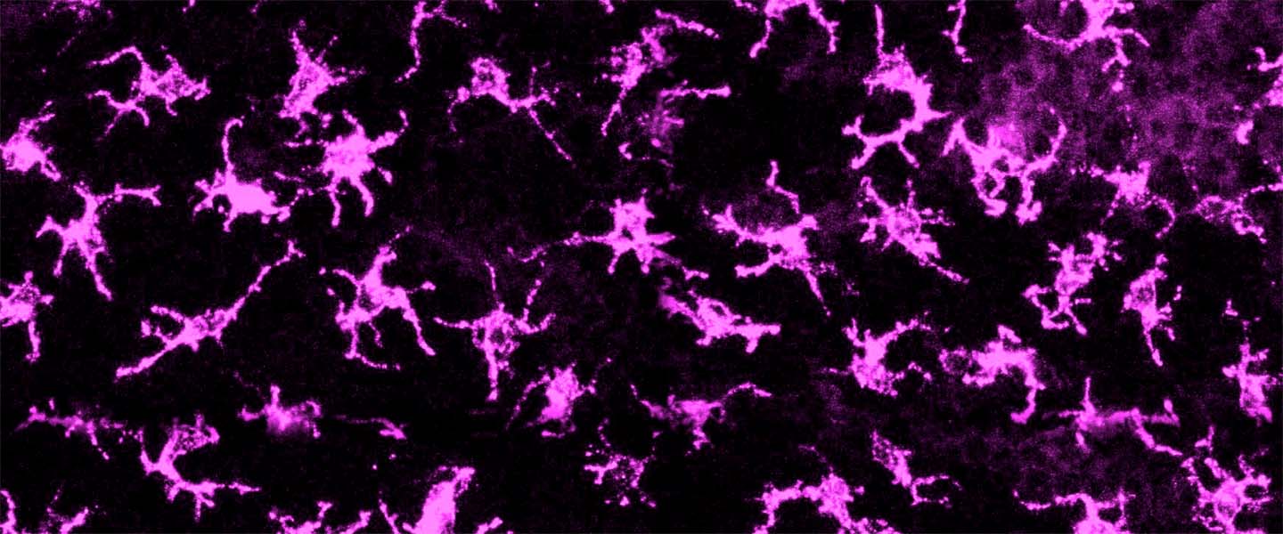 menichella-neurons-1440x600.jpg