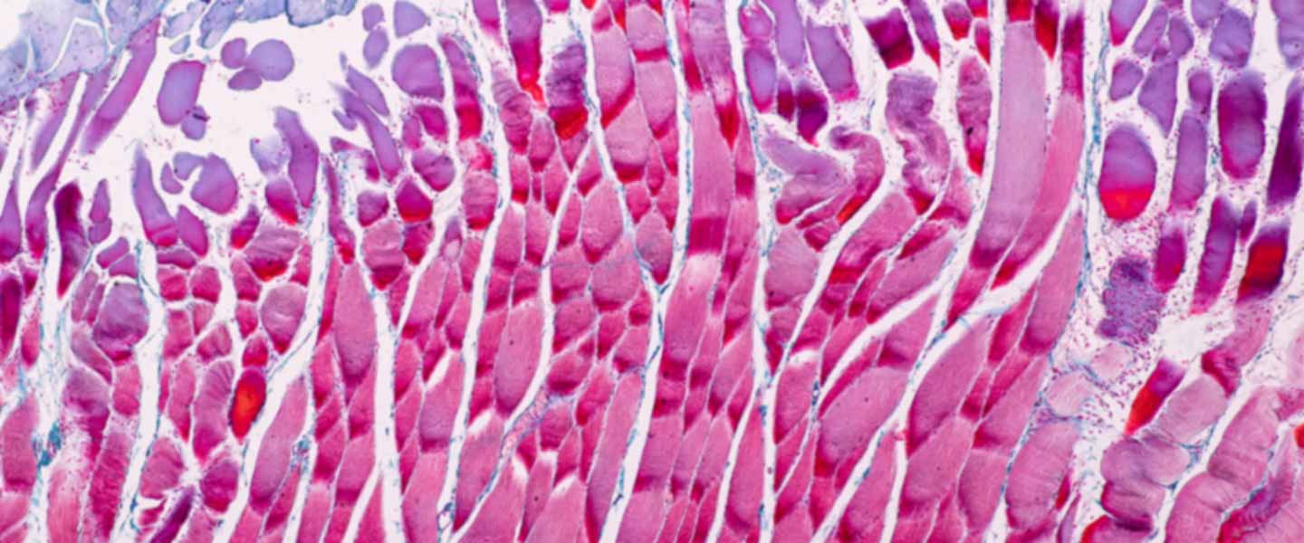 muscle-cells-1440x600.jpg