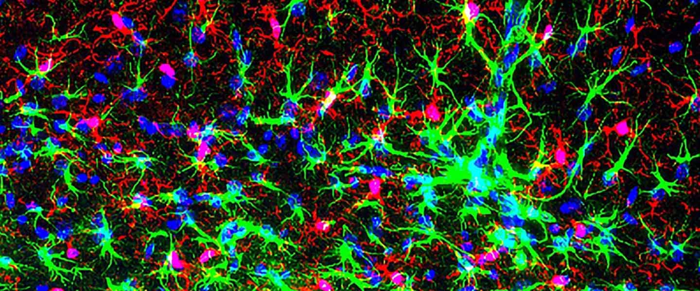prakriya-neurons-1440x600.jpg