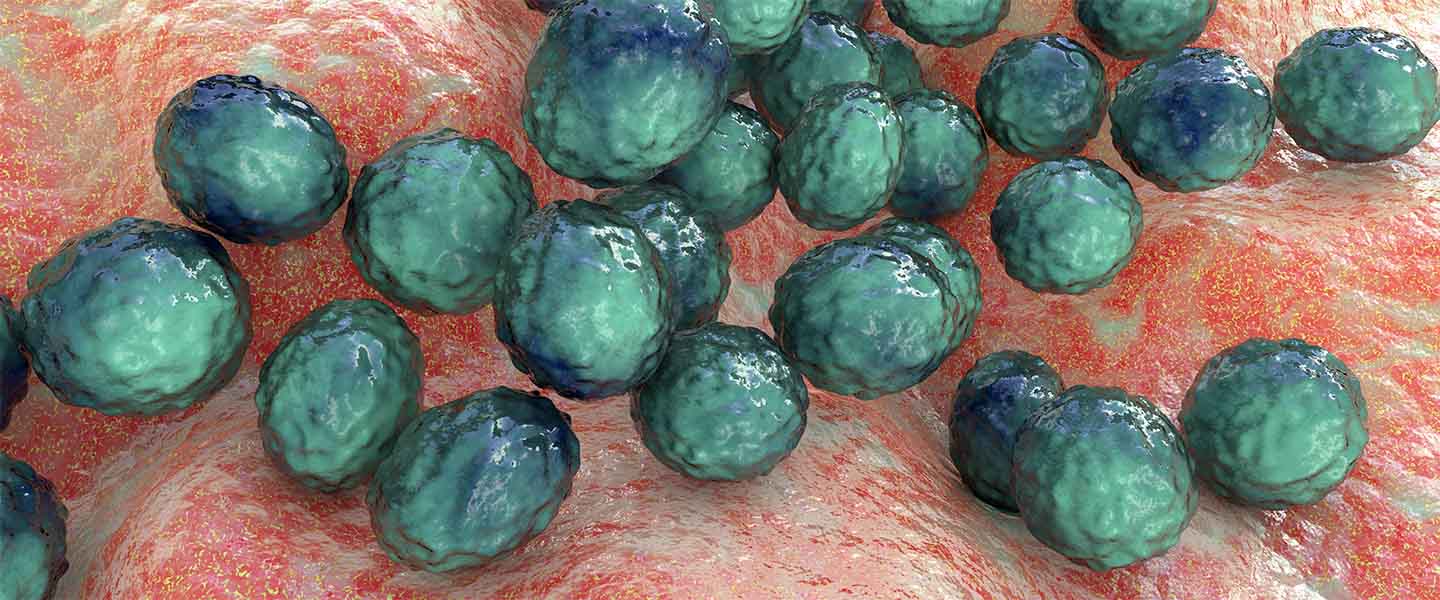 staph-bacteria-1440x6001.jpg
