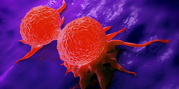 New Breast Cancer Therapy Examined