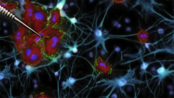 Cold Virus, Stem Cells Tested to Destroy Deadly Brain Cancer
