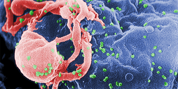 Molecular Mechanism Behind HIV-Associated Dementia Revealed