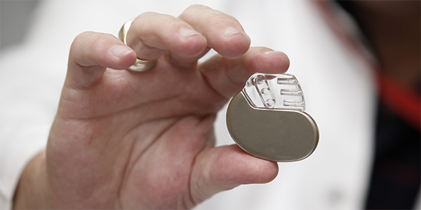 Pacemakers Could Help Avoid Future Strokes