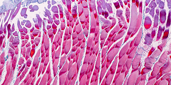 Tissue Environment Shapes Gene Regulation in Skeletal Muscles