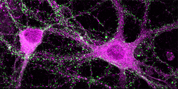 Decoding Hidden Brain Conversations to Advance Neuroprostheses