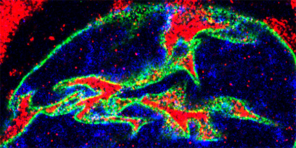 Delving into the Cellular Mechanisms Underlying ALS