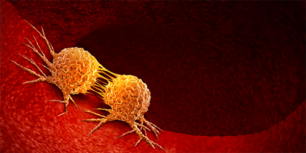 First Trial Shows Benefit for Genomically Targeted Prostate Cancer Treatment