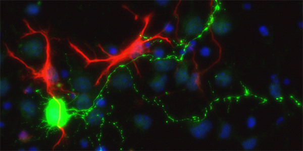 Proteins on Neuron Surfaces Prove Pivotal for Communication
