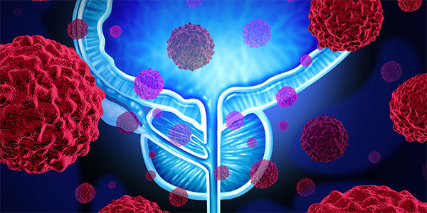 New Path Forward for Pancreatic Cancer Treatment
