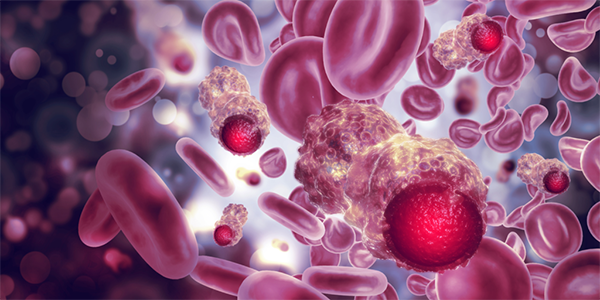 Inflammatory Signaling Linked to Leukemia Progression