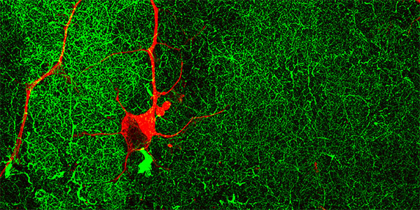 Mature ‘Lab Grown’ Neurons Hold Promise for Neurodegenerative Disease