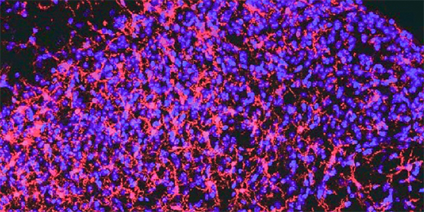 Calcium Channels Regulate Neuroinflammation and Neuropathic Pain 