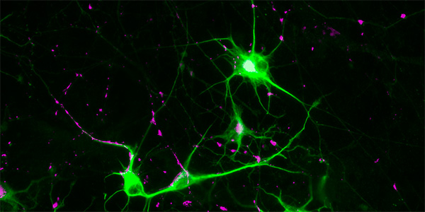 Potential Therapeutic Target for Schizophrenia Identified