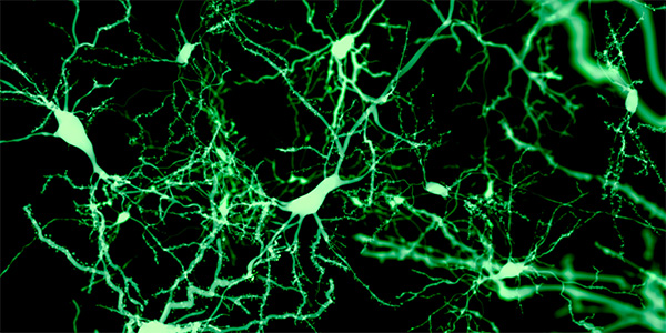 Uncovering the Causes of Neuron Dysfunction in Huntington’s Disease 