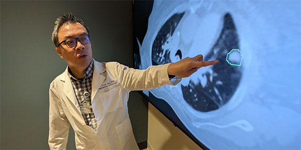 AI Matches Doctors in Mapping Lung Tumors for Radiation Therapy