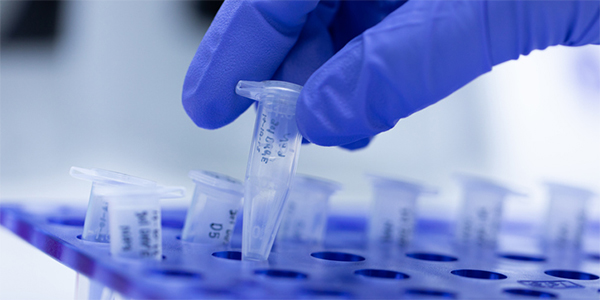 First Gene Regulation Clinical Trials for Epilepsy Show Promising Results