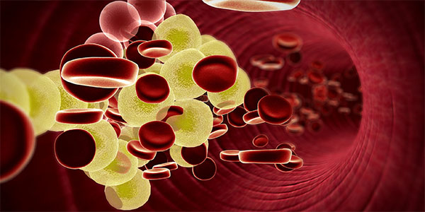 Little-Used Cholesterol Test Could Prevent More Heart Attacks, Strokes