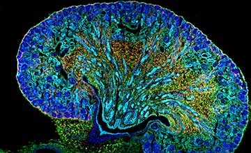 A scientific image of a kidney