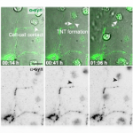 Alzforum Spotlights TNT Research