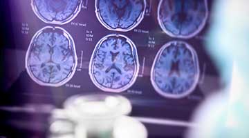 Images from a brain scan