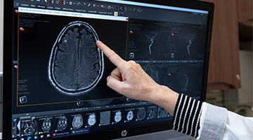 Images from a brain scan