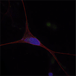 Podcast: How Cell Function Can Shed Light on Neurodegeneration with Vladimir Gelfand, PhD