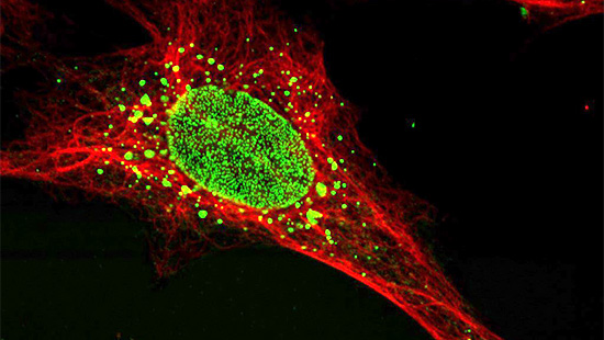 photo of cell nucleus