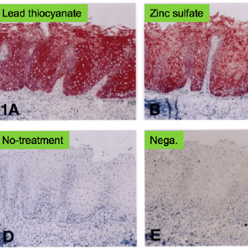 Antigen Retrival Technique