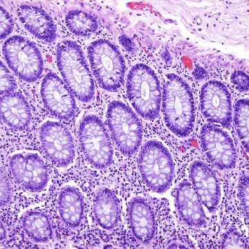 Hematoxylin and Eosin Staining