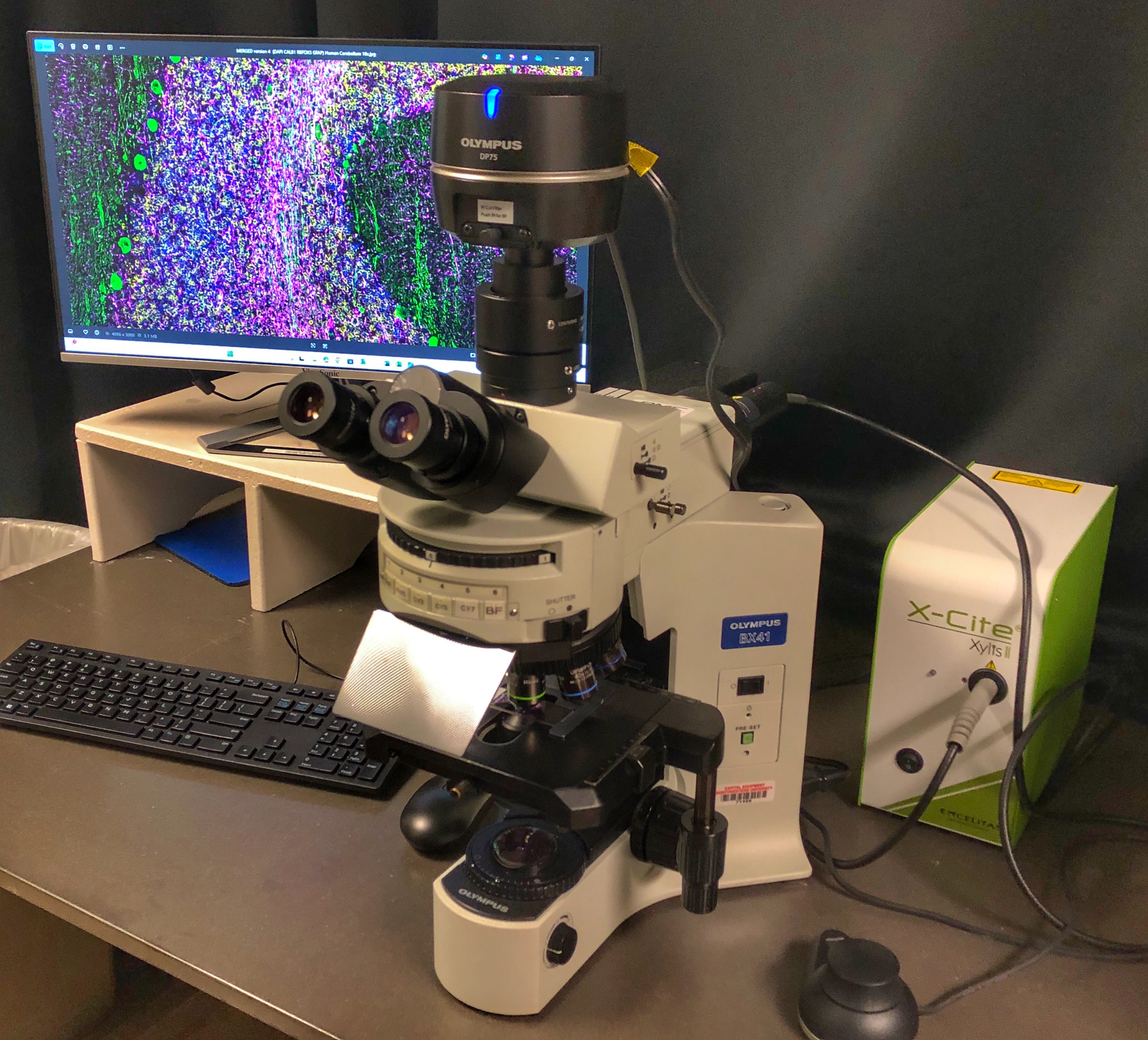 Olympus BX41 Microscope