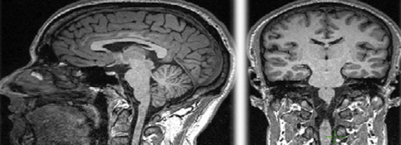 elliott-neuromuscular836x300.jpg